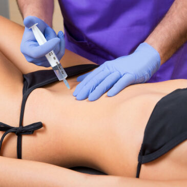 Mesoterapia Corporal