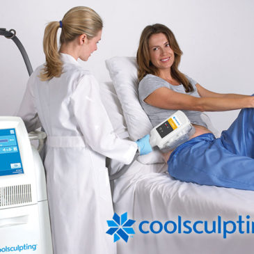 CoolSculpting