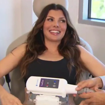 Coolsculpting Criolipólisis