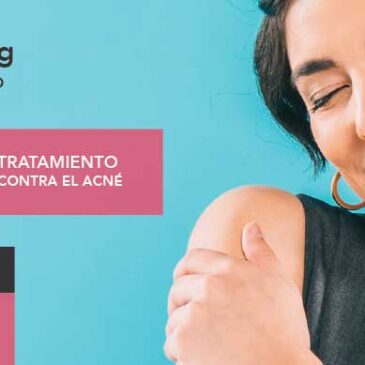 Smart Peeling, Promoción Marzo 2022